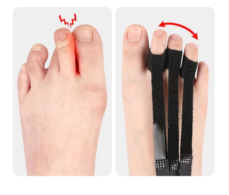 AlignaToe™ – Attelle de Correction d’Orteil
