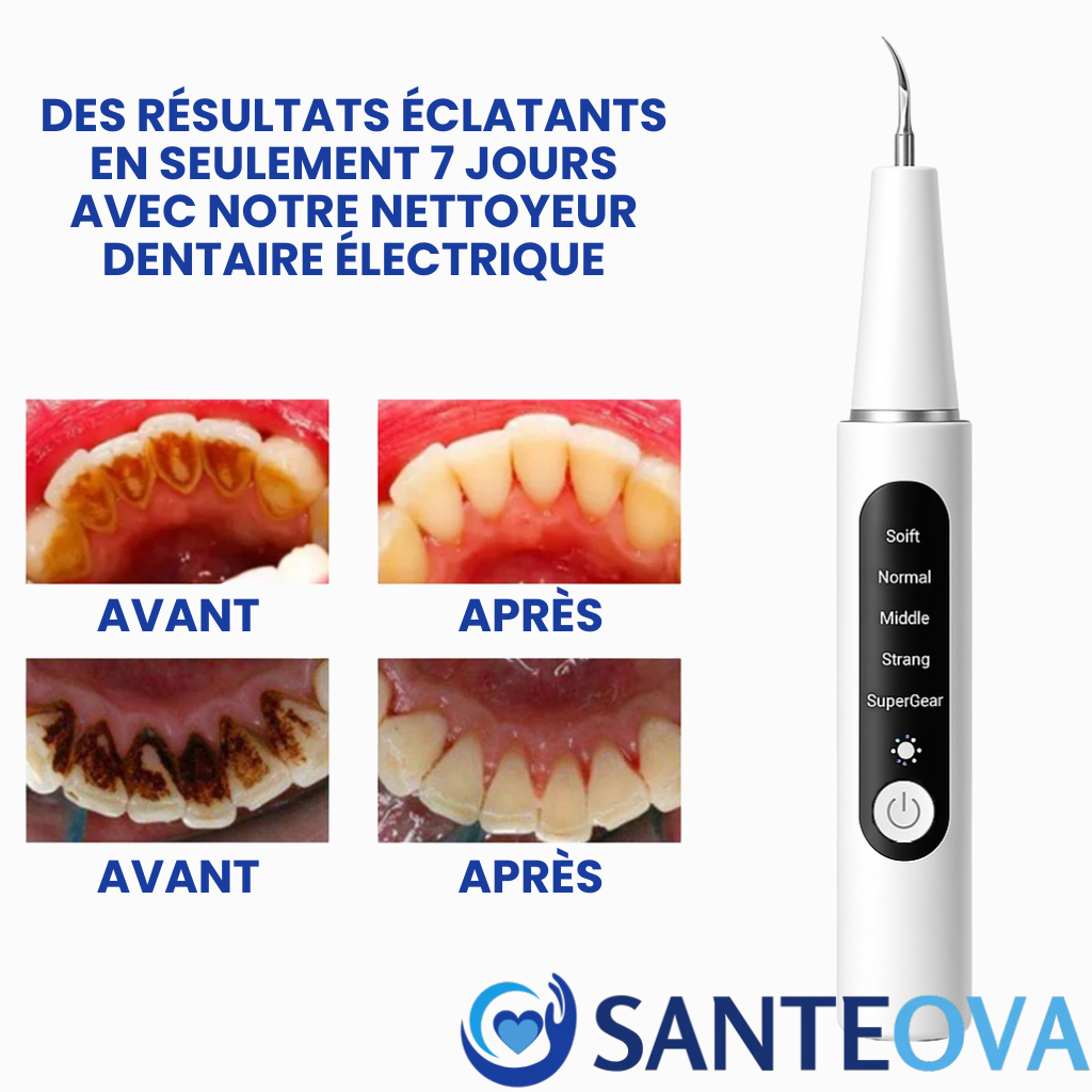 AquaDent™ – Détartreur Dentaire Électrique Rechargeable à 4 Embouts