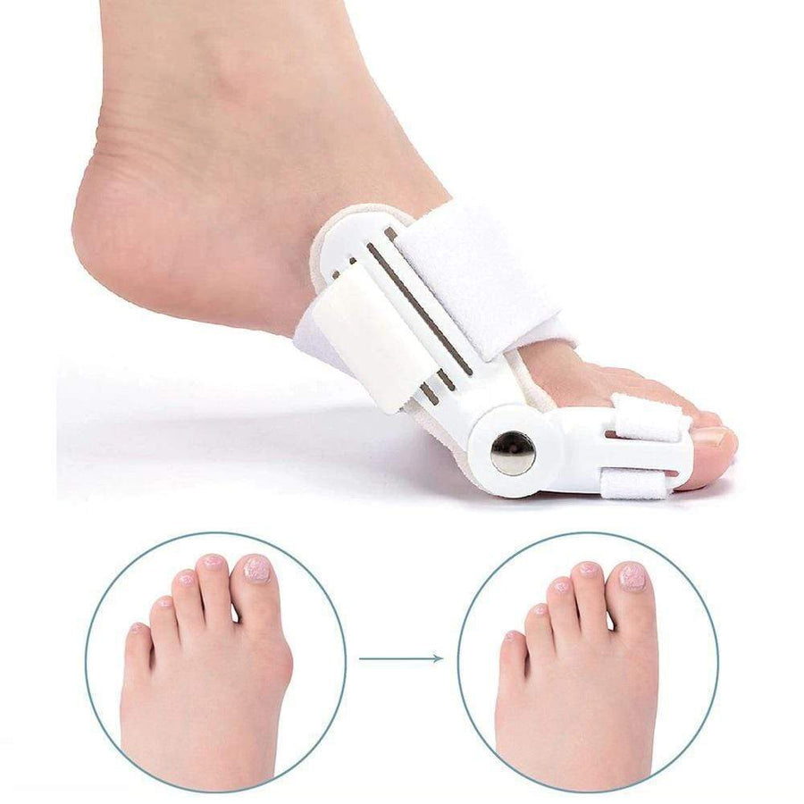 BunionAlign™ – Correcteur Orthopédique d’Oignon Ajustable & Confortable