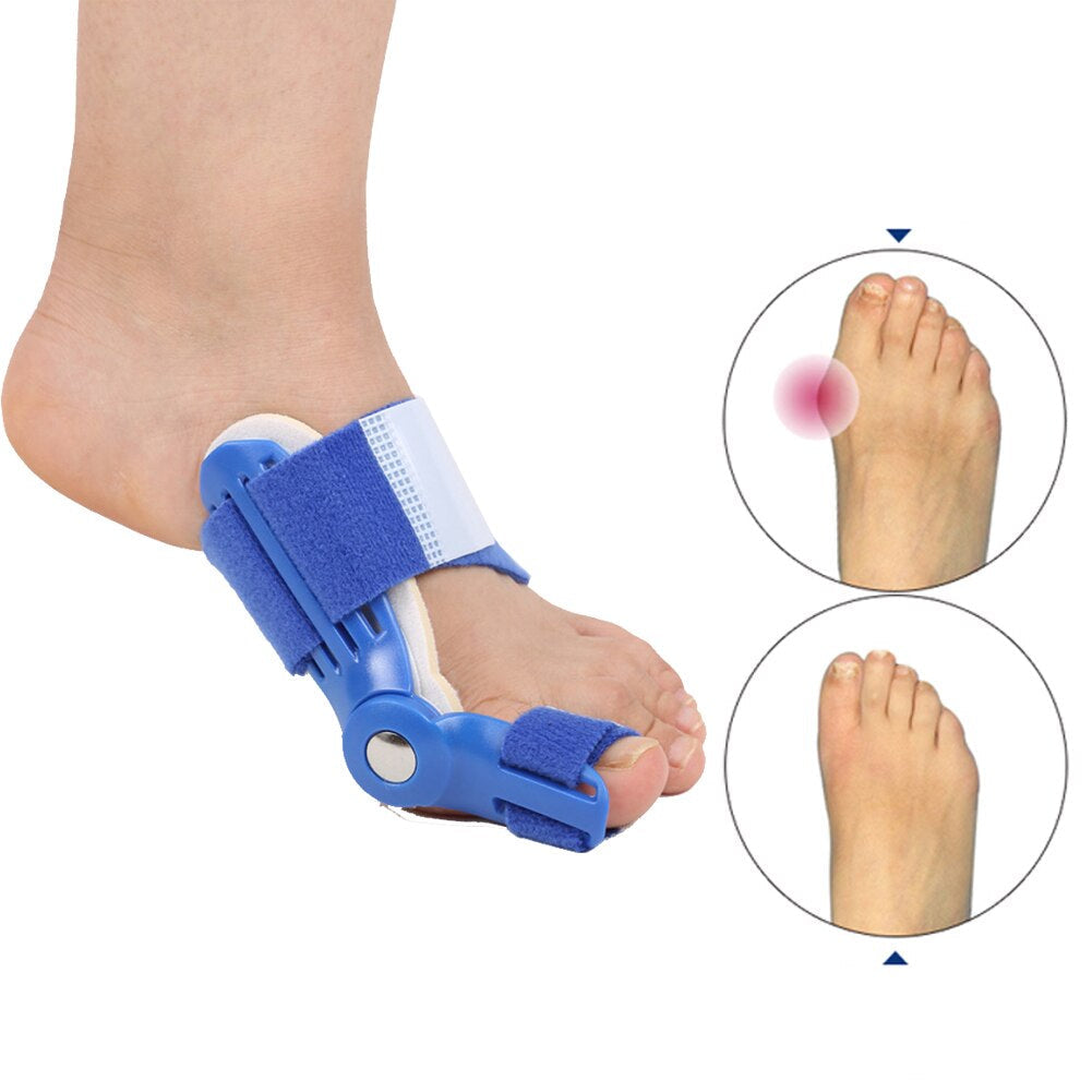 BunionAlign™ – Correcteur Orthopédique d’Oignon Ajustable & Confortable