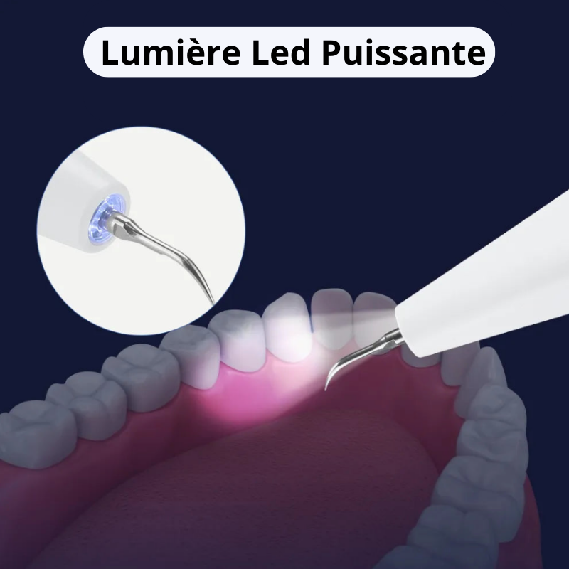 Dentapulse™ – Détartreur Dentaire Ultrason pour Plaque & Tartre à Domicile